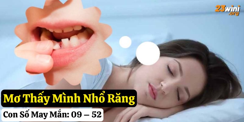 23win mơ rụng răng giải mã