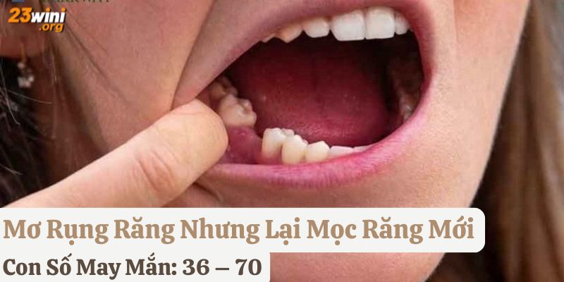 rụng răng 23win