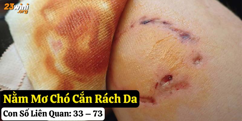 nằm mơ thấy chó cắn