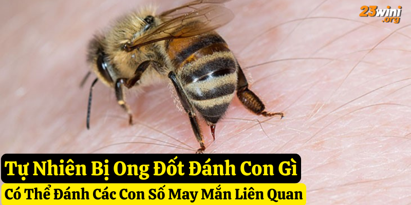 tự nhiên bị ong đốt đánh gì