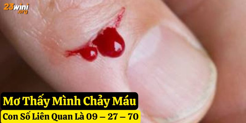 giấc mơ thấy chảy máu 23win